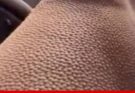 If you get goosebumps for no reasons, it is a clear sign that you are….