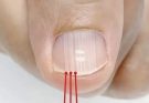 If you have these lines on your nails after 40, it is a clear sign that.. Check 1st comment