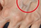 If you have visible veins it means you are…See more
