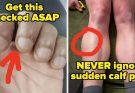 Doctors And Nurses Are Revealing The “Small” Health Signs You Should Never Ignore, And It’s Shocking