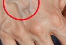 If you have visible veins it means you are…See more