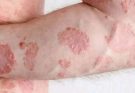 These are the consequences of sleeping with the…See more