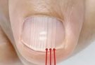 If you have these lines on your nails after 40, it is a clear sign that..