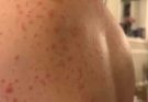 These are the consequences of sleeping with the…See more
