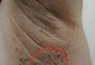 These are the first symptoms of cr…See more