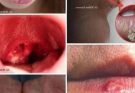 These are the signs that he is cr… See more