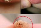 These are the first signs of an enf…See more