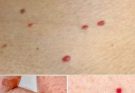 If you spot these red dots on your skin, you had better know what they mean I had no clue!