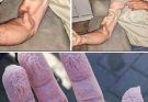 A man goes to stretch and ends up feeling a sharp pain in his arm, it was a ca… See More