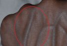  If your veins are visible in your hand, it is a signal of ca… See more