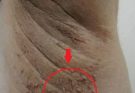 These are the first symptoms of cr…See more