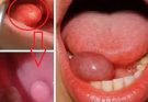 These are the first symptoms of a… See more