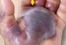 ATTENTION to these first signs of…See More