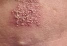 These are the consequences of sleeping with…See more