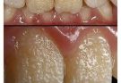 Be careful!! This is what your teeth will become when you eat…see more