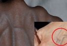 If you have these visible veins in your hand it’s a sign of can…See more
