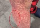 These are the consequences of sleeping with many…