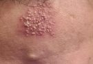 These are the consequences of sleeping with…See more