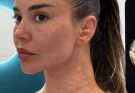 She Thought It Was Just a Simple Allergy at First — But What Doctors Discovered After Further Testing Turned Out to Be Far More Serious, Life-Altering, and Unexpected Than Anyone Could Have Ever Imagined, Changing Her Life Forever