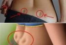 If you have these two holes in your back